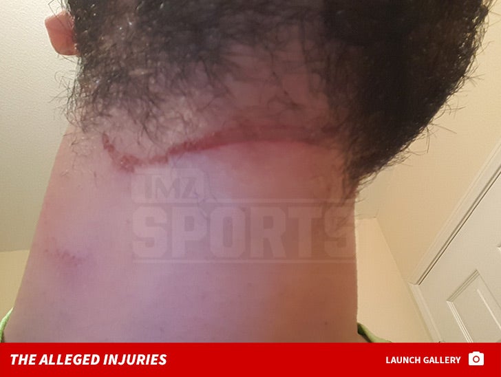 Robert Horry -- The Alleged Injuries