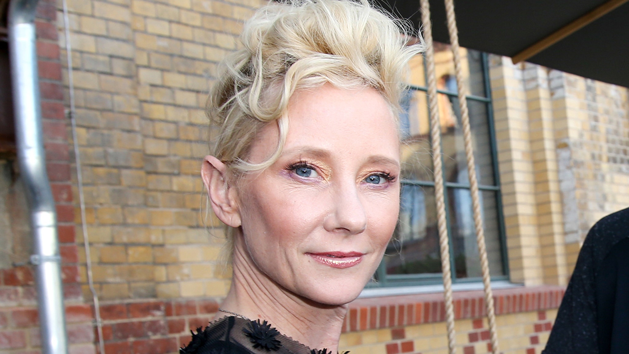 Anne Heche Suffered Severe Brain Injury, Not Expected to Survive