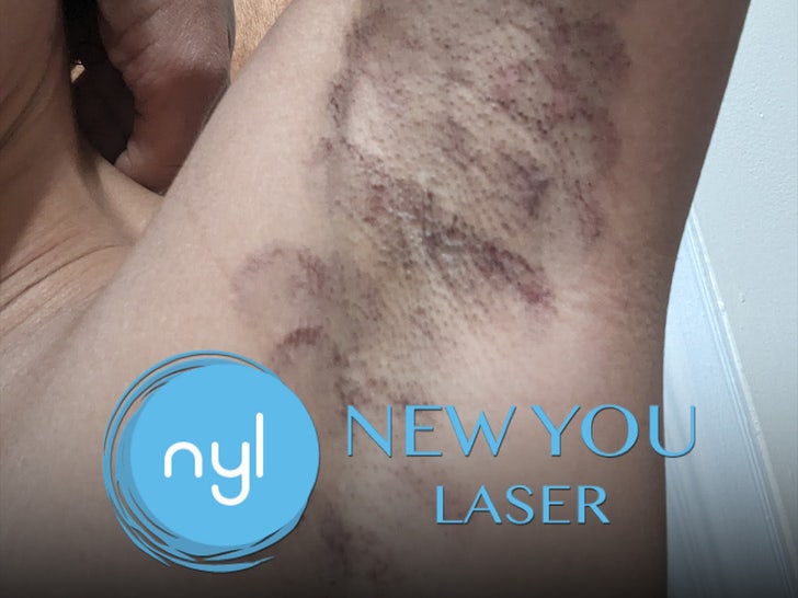 new you laser main