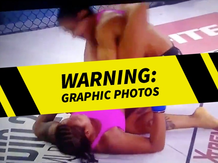 MMA Fighter Gruesomely Breaks Arm Mid-Round