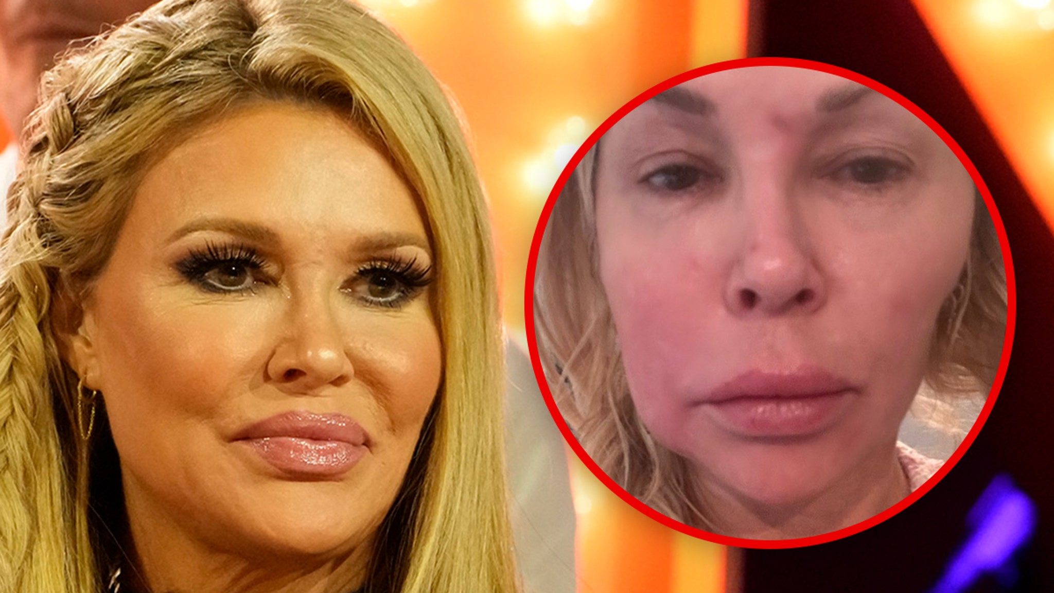 Brandi Glanville Admits She Hasn’t Had Sex In Over A Year Because of Face Issue