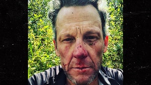 Lance Armstrong Hospitalized After Bloody Bike Crash