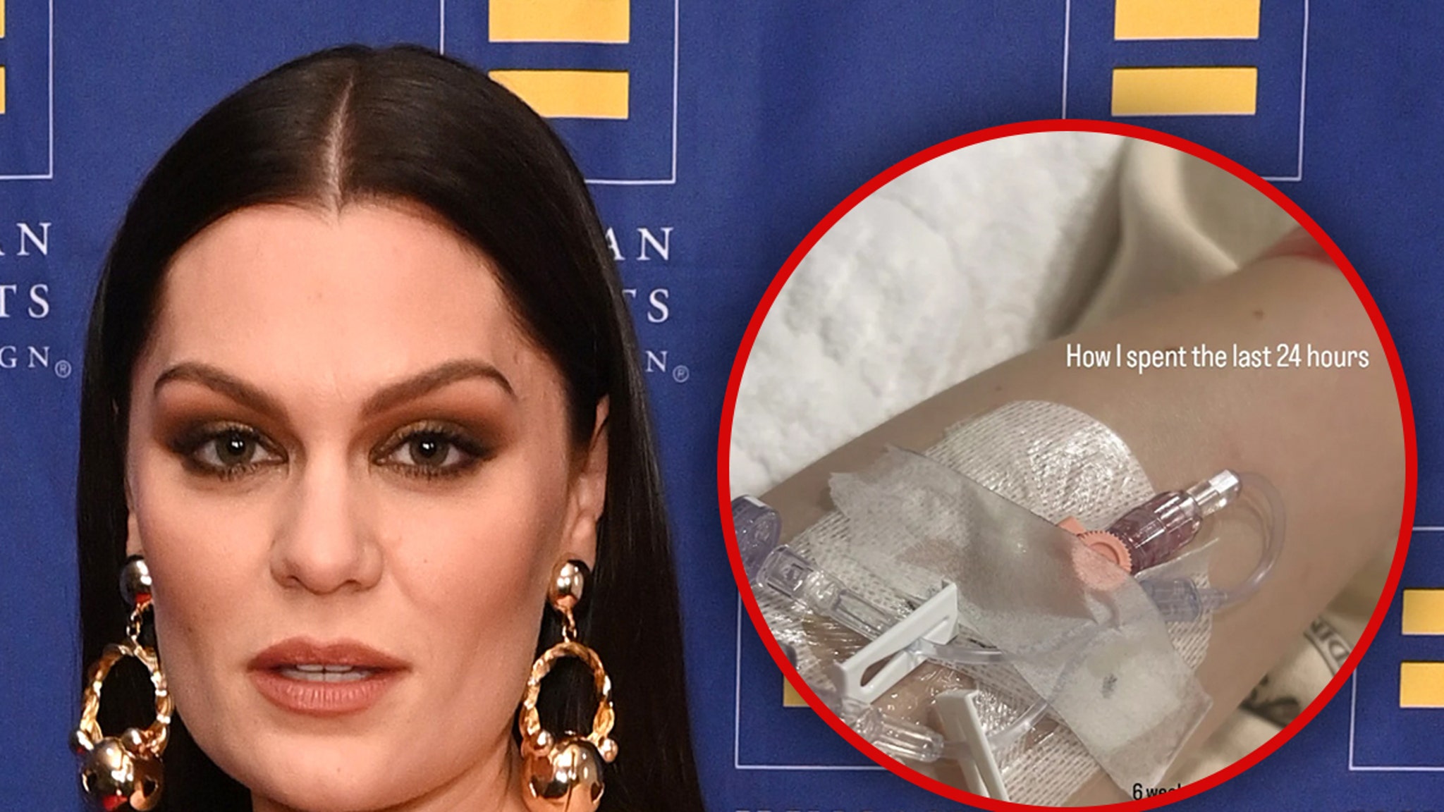 Jessie J Hospitalized With Infection Weeks After Breast Cancer Surgery