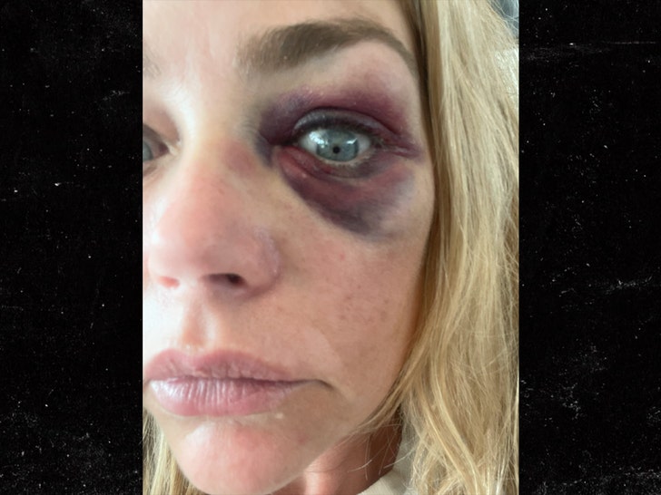 denise ricahrds and Aaron Phypers alleged injuries lawsuit 2