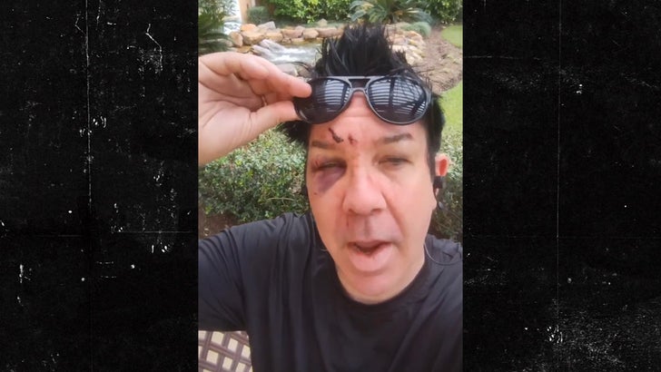 Crazy Town Band Members Shifty Shellshock and Bobby Reeves Fight on Video