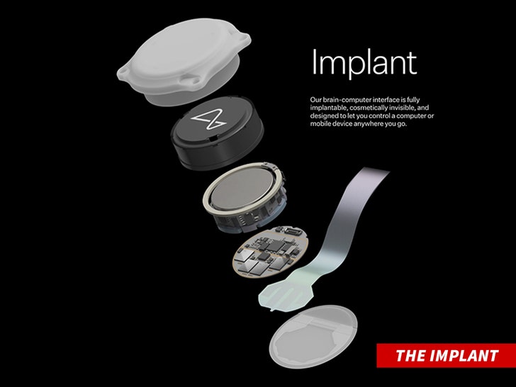 Six parts that make up a neuralink implant device.