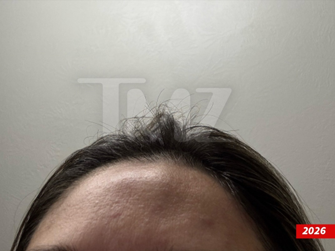 Dakota-Mortensen-Alleged-Injuries-Swipe- 4