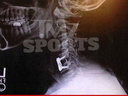 03-25-14-rob-williams-xray-tmz