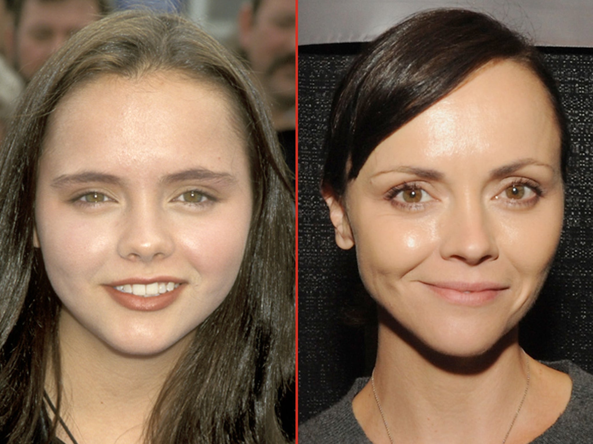 Christina Ricci Before Surgery