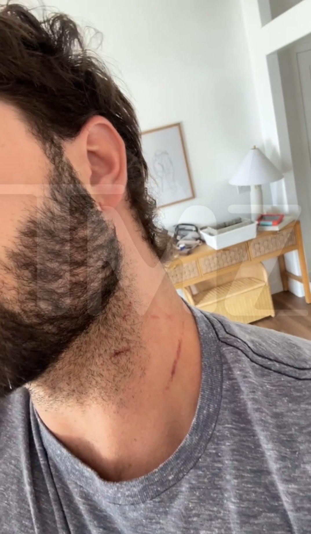 Dakota Mortensen Alleged Injuries 7