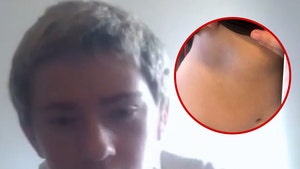 3 teens accused of assault dodgeball game 3