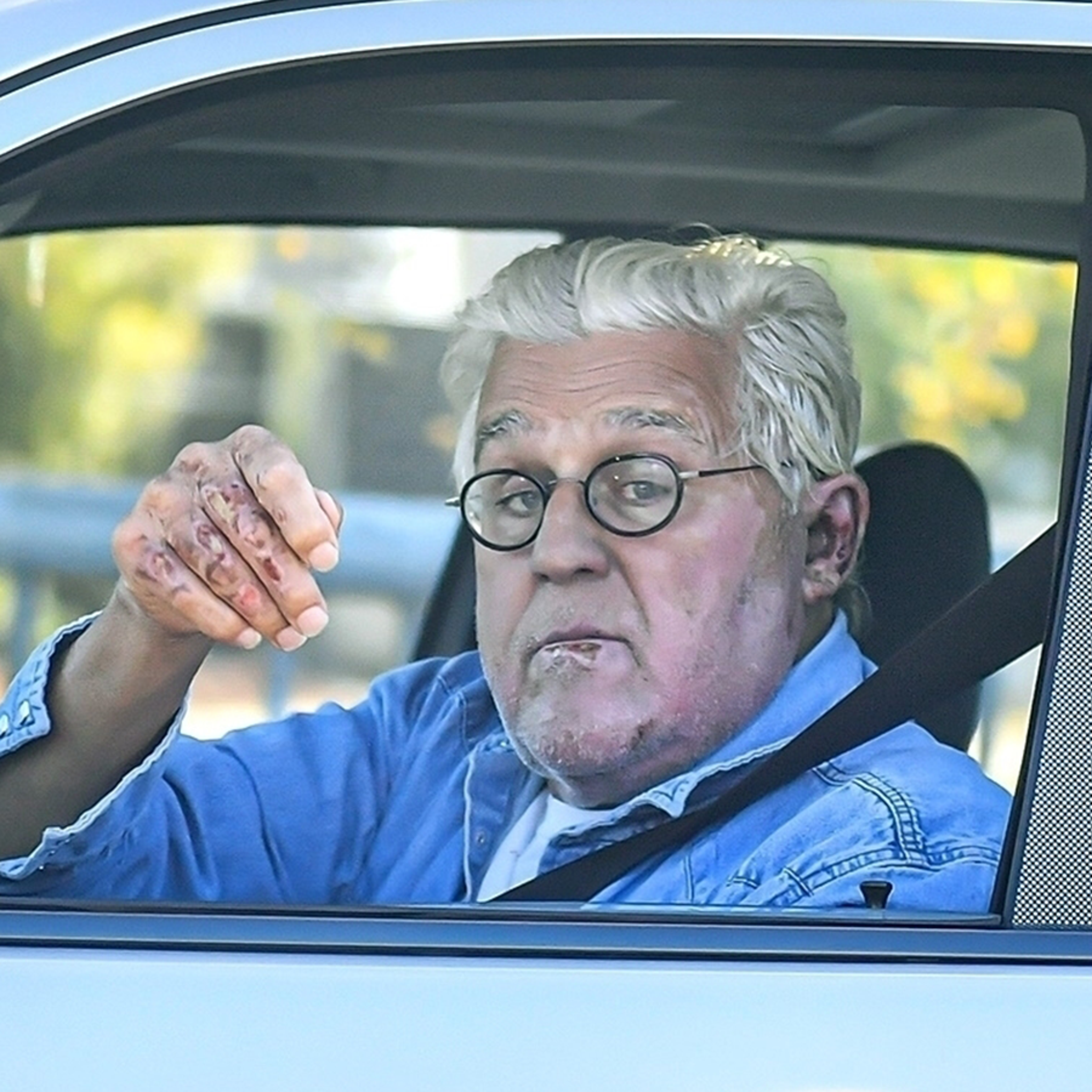 Jay Leno Heads Back to Garage 10 Days After Car Fire Accident - TMZ (Picture 2)