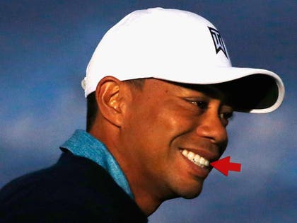 0127-tiger-woods-tooth-getty-01