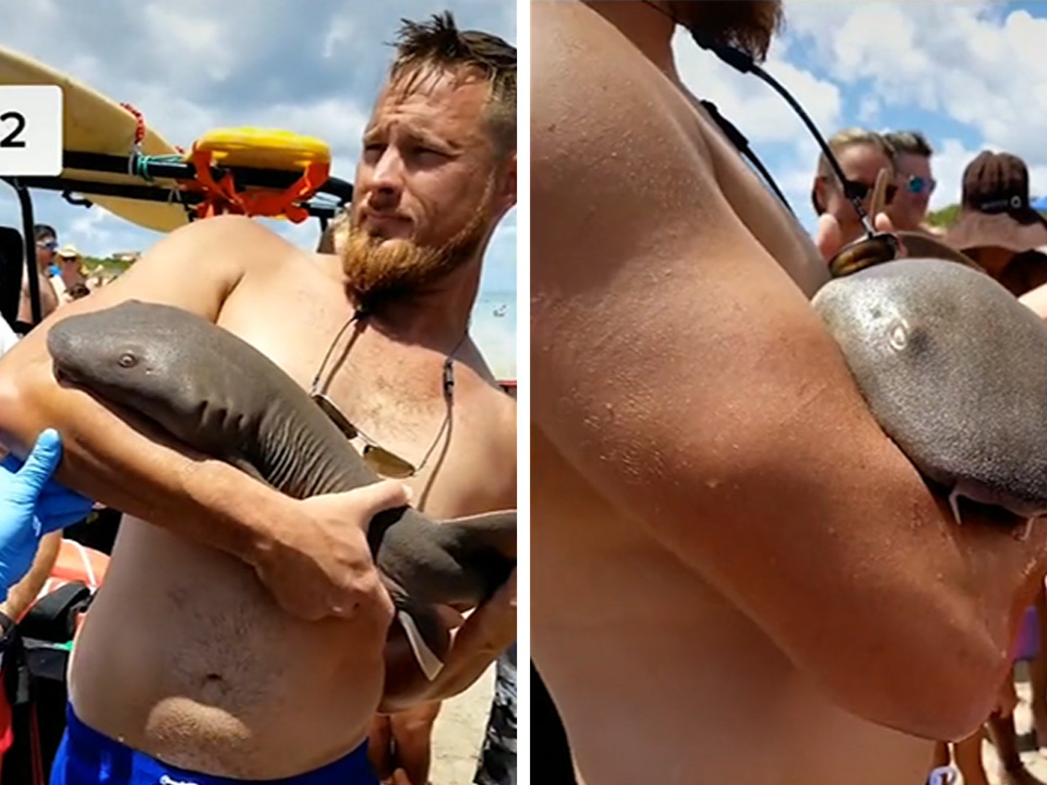 Baby Shark Bites Man S Arm Latches On Even After He Gets Out Of Water