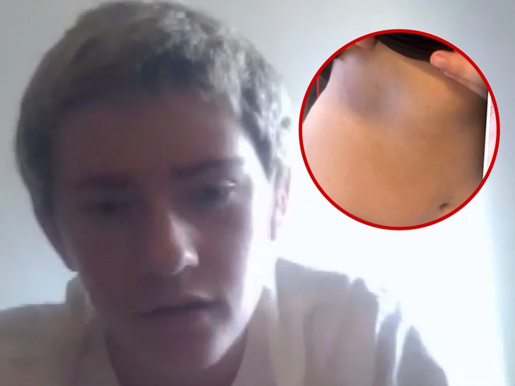 3 teens accused of assault dodgeball game 3