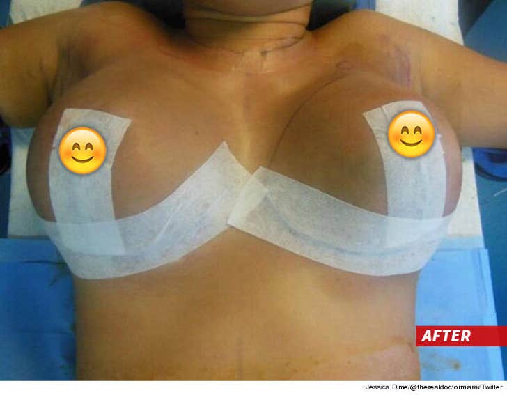 Love & Hip Hop' Star: DDDelightful Downsize  Check Out My New Boobs!!!