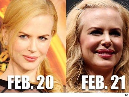 Kidman's lips