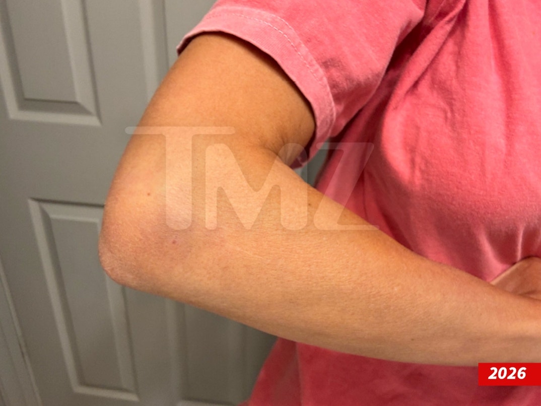 Dakota-Mortensen-Alleged-Injuries-Swipe- 5