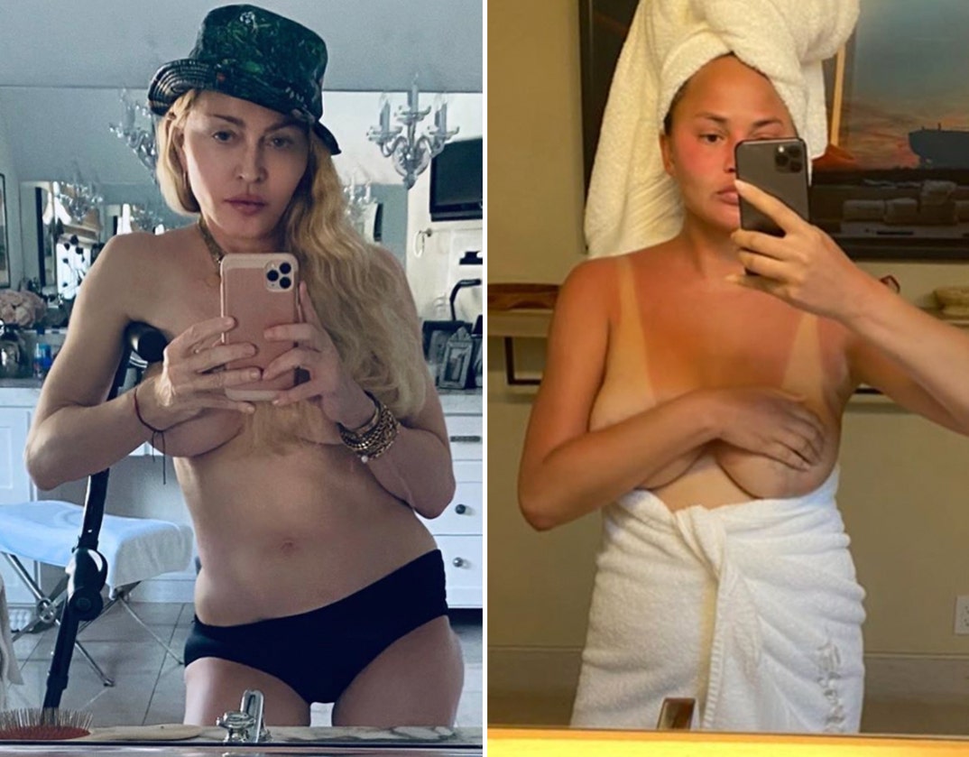 Madonna (61) vs. Chrissy Teigen (34) -- Topless Babes Edition