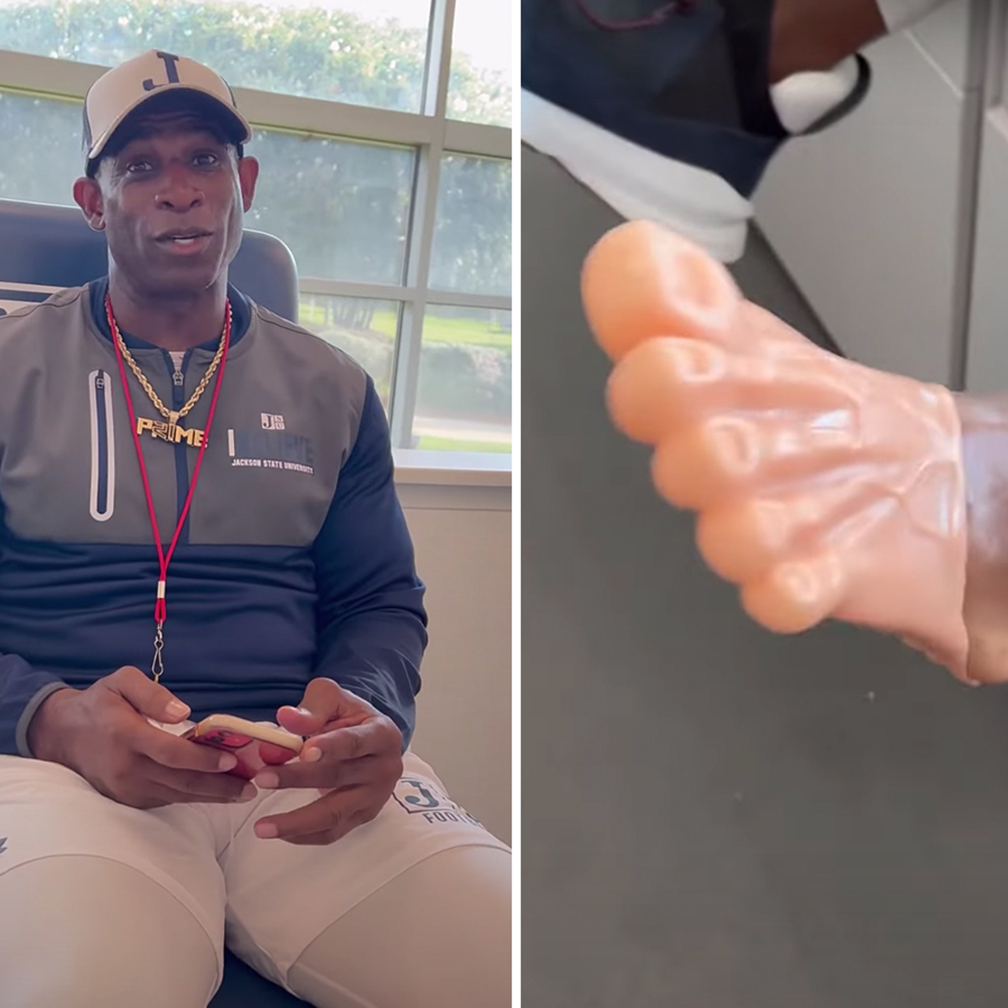 How Deion Sanders' foot surgery recovery is going: 'It's hurting