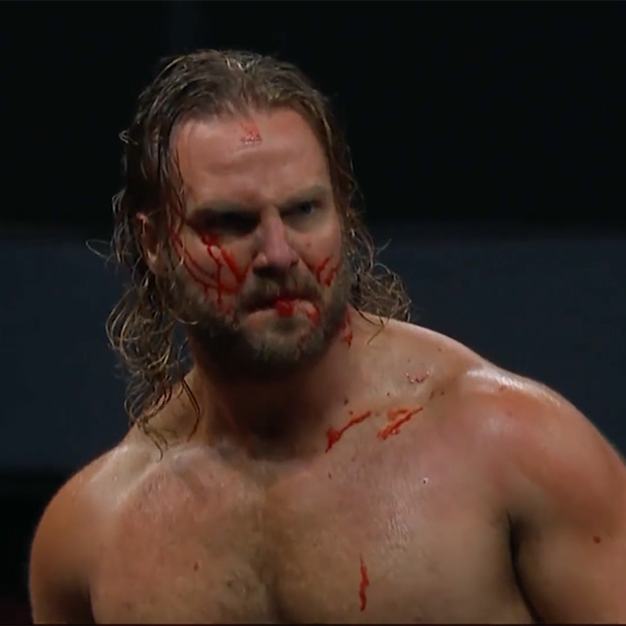 What Happened to Adam Page? AEW Wrestling Star Injured