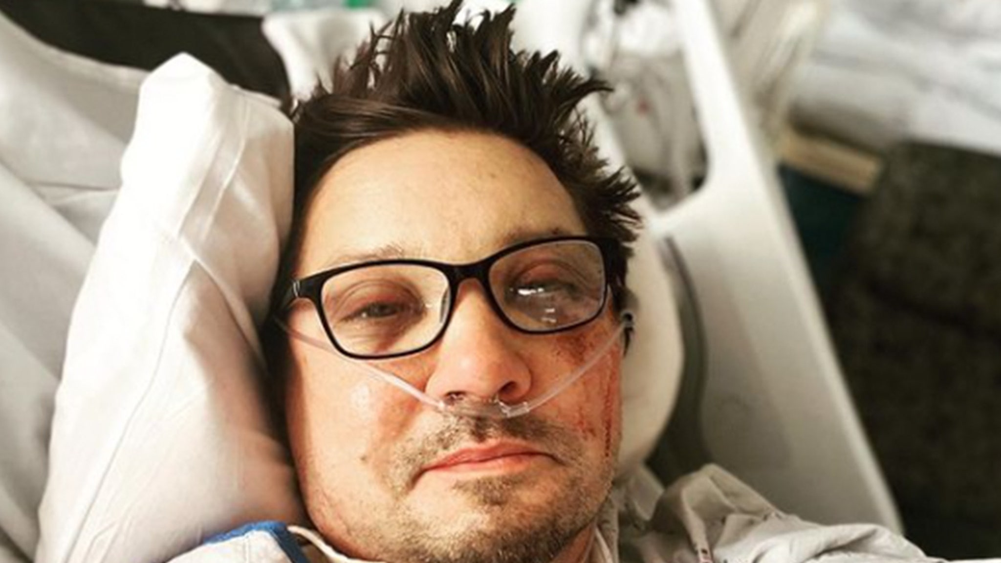 Jeremy Renner Shares Photo of Injuries Following Snowplow Accident