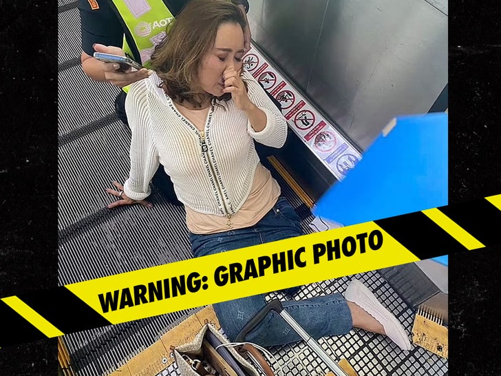 Woman Loses Leg After Getting It Caught in an Airport Travelator -- Graphic Photos