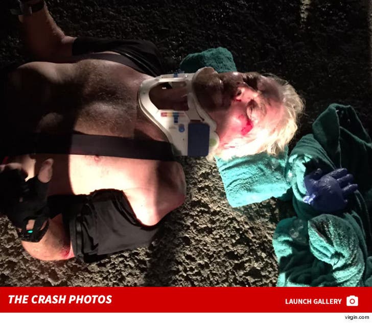 Richard Branson's Bike Crash Injuries