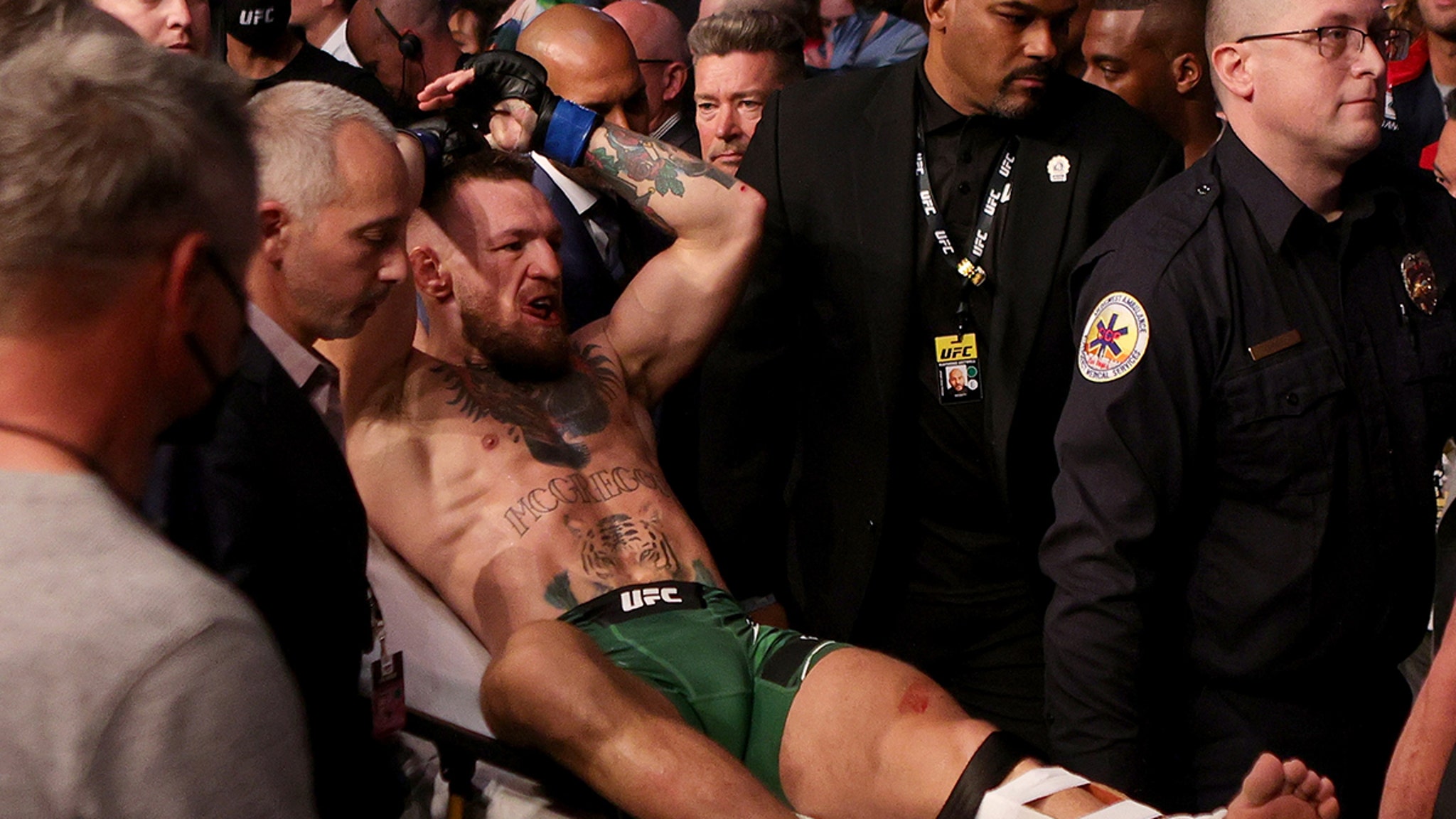 Conor McGregor Released From Hospital After Surgery On Broken Leg