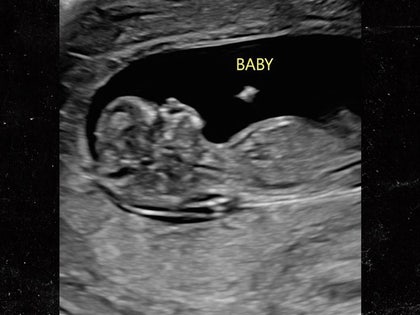 Pregnant WWE Star Becky Lynch Shares First Ultrasound Photo