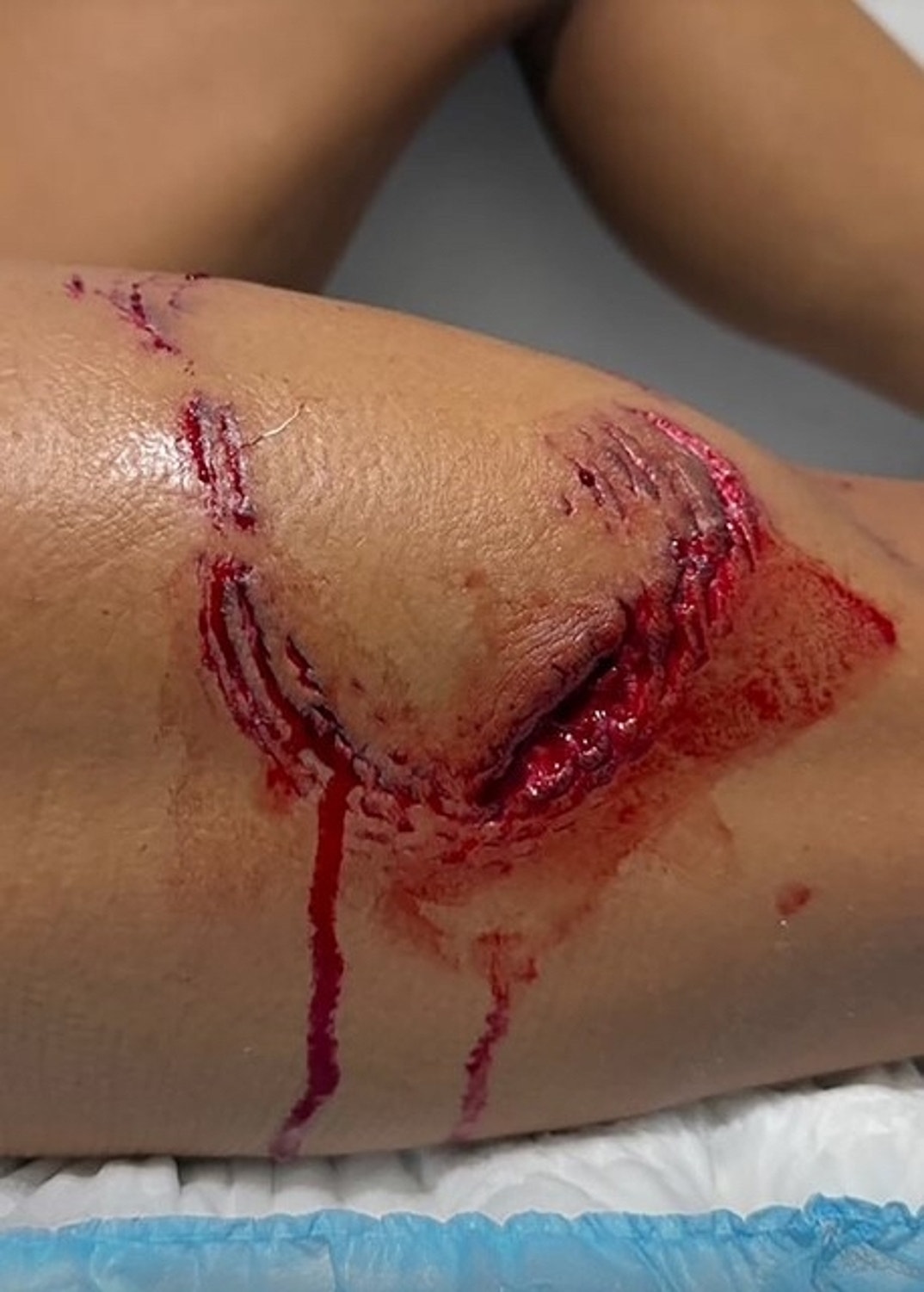 Lawyer Tayane Dalazen Shark Attack 1