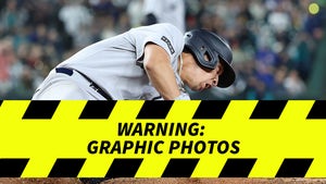 Oswaldo Cabrera Leg Injury At Home Plate While Playing Baseball
