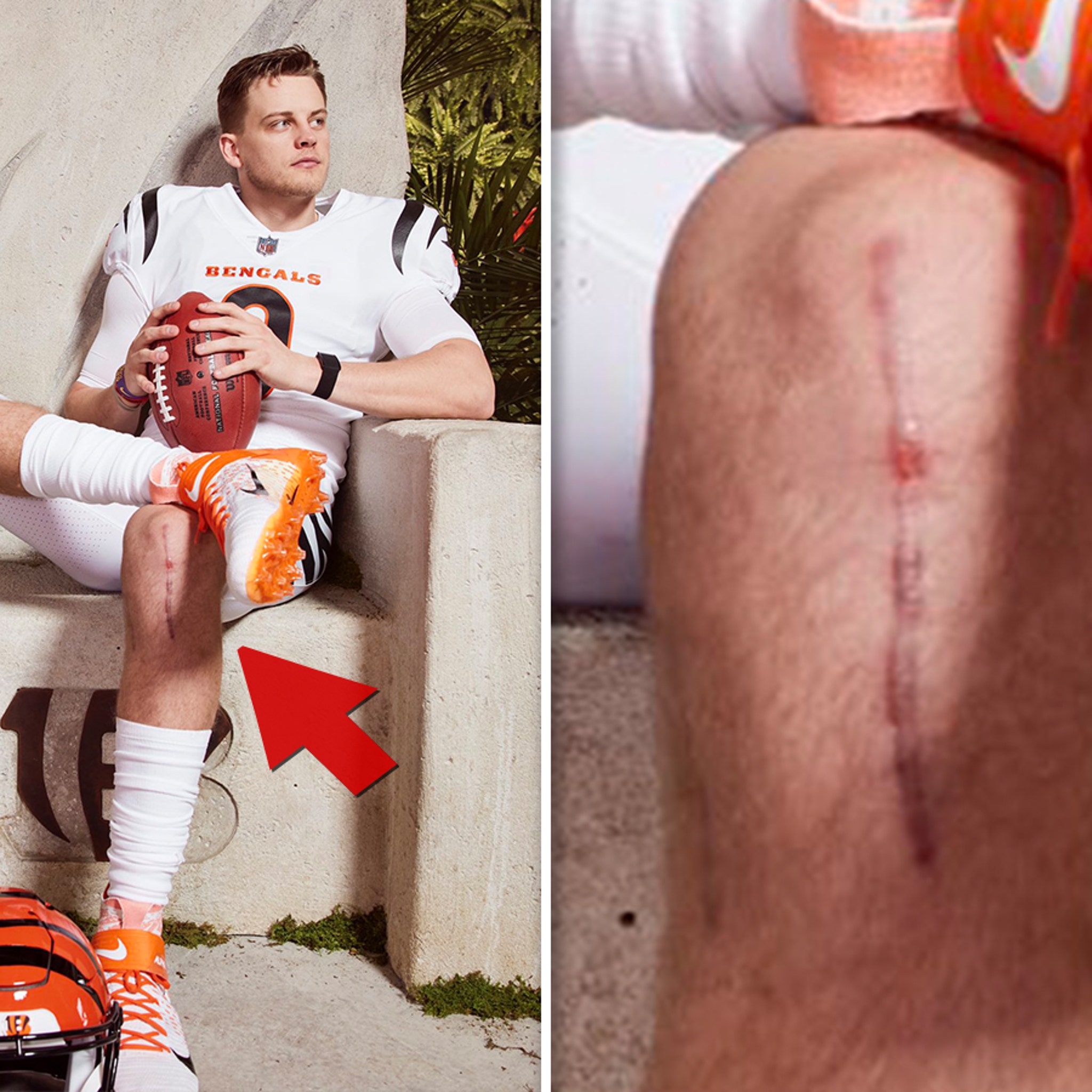 What Happened to Joe Burrow? Calf Injury Update, Why He's Hurt – StyleCaster