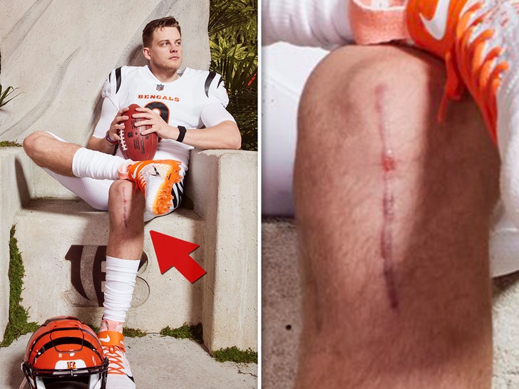 Joe Burrow's Huge, Gnarly ACL Surgery Scar Shown During Bengals' Jersey