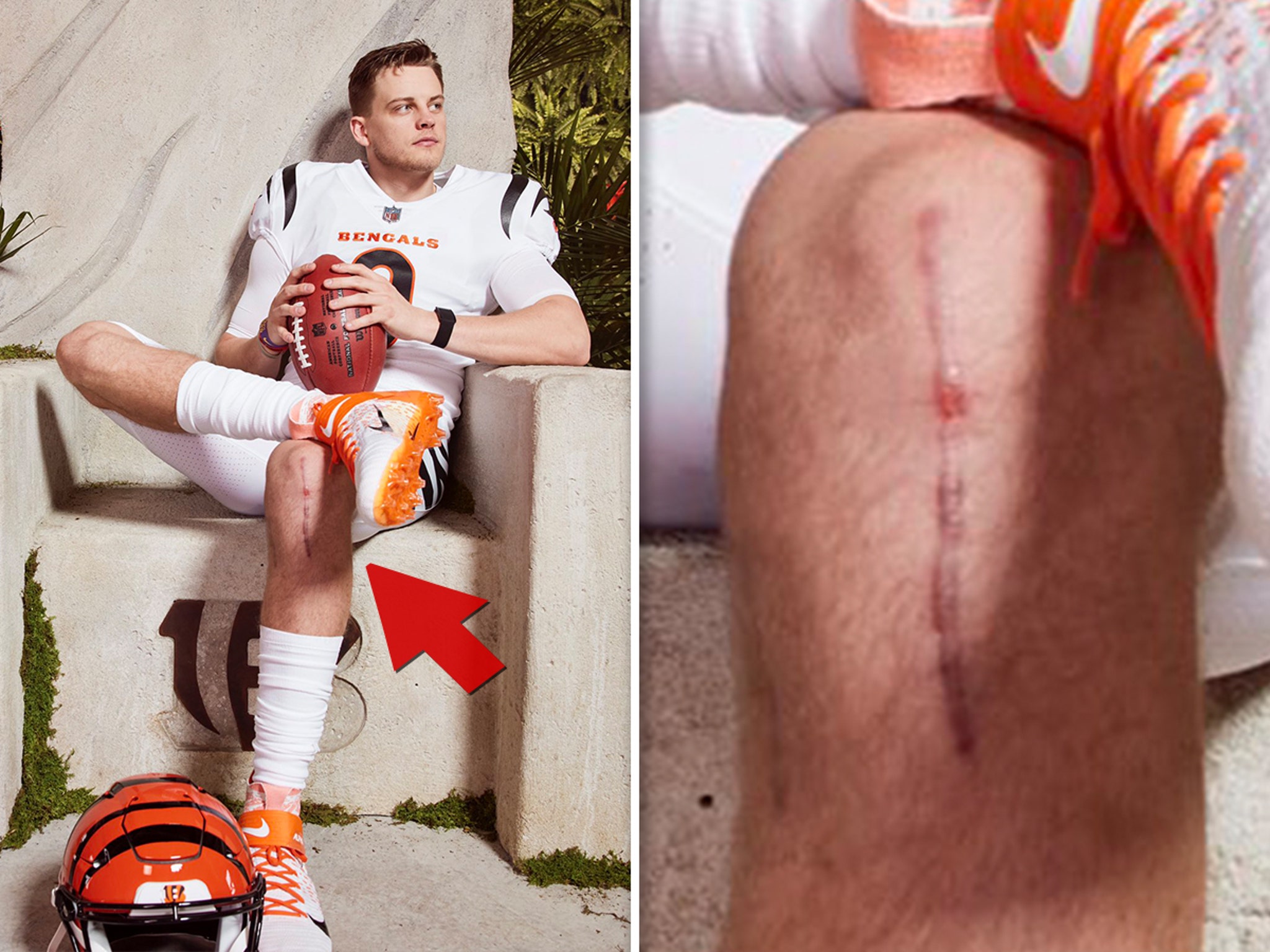 Joe Burrow's Huge, Gnarly ACL Surgery Scar Shown During Bengals' Jersey  Reveal