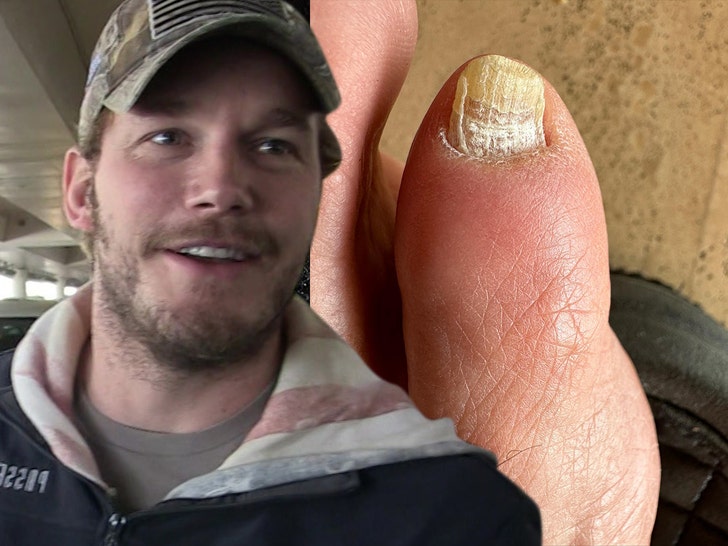 chris pratt toe insta tmz