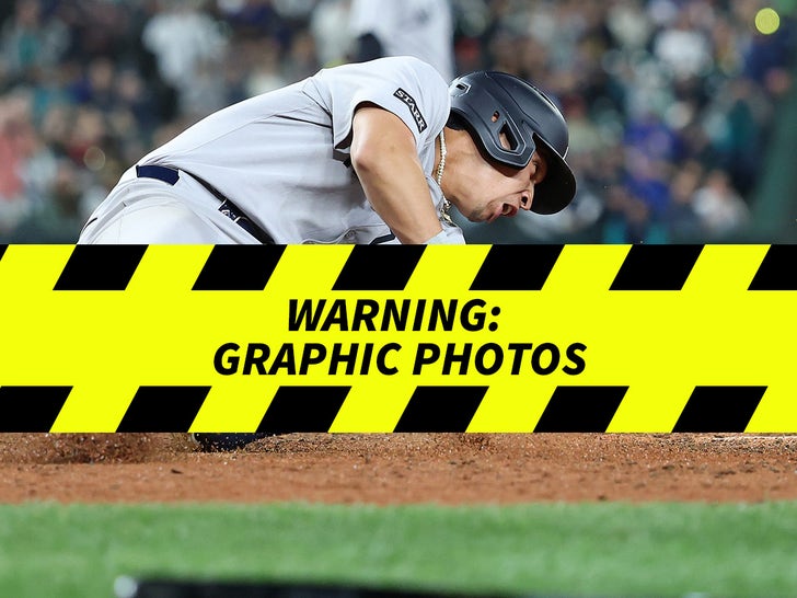 Oswaldo Cabrera's Gruesome Leg Injury At Home Plate
