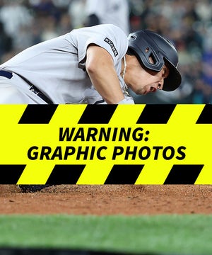 Oswaldo Cabrera Leg Injury At Home Plate While Playing Baseball
