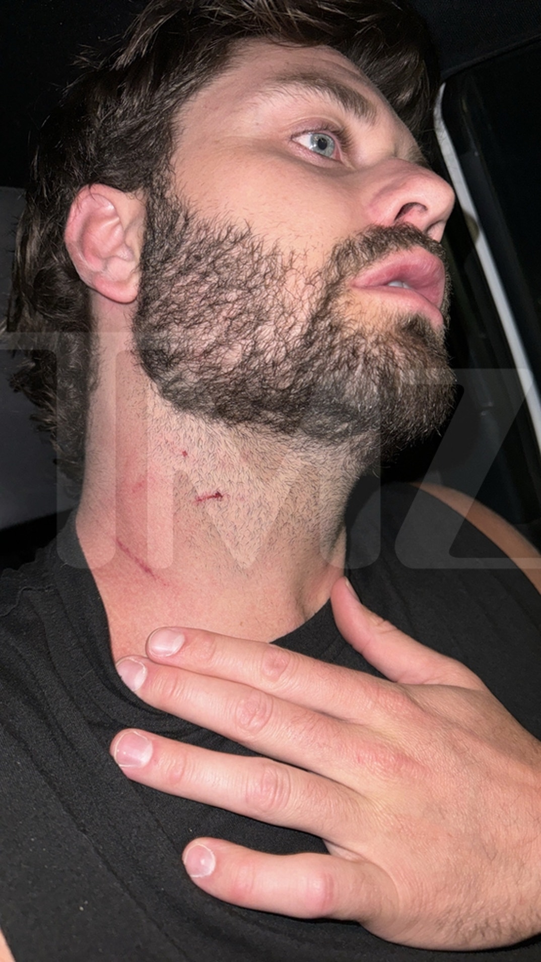 Dakota Mortensen Alleged Injuries 0