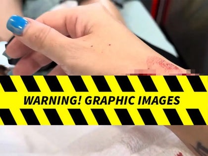 0818-Car-Crashes-Into-Couple-PRIMARY