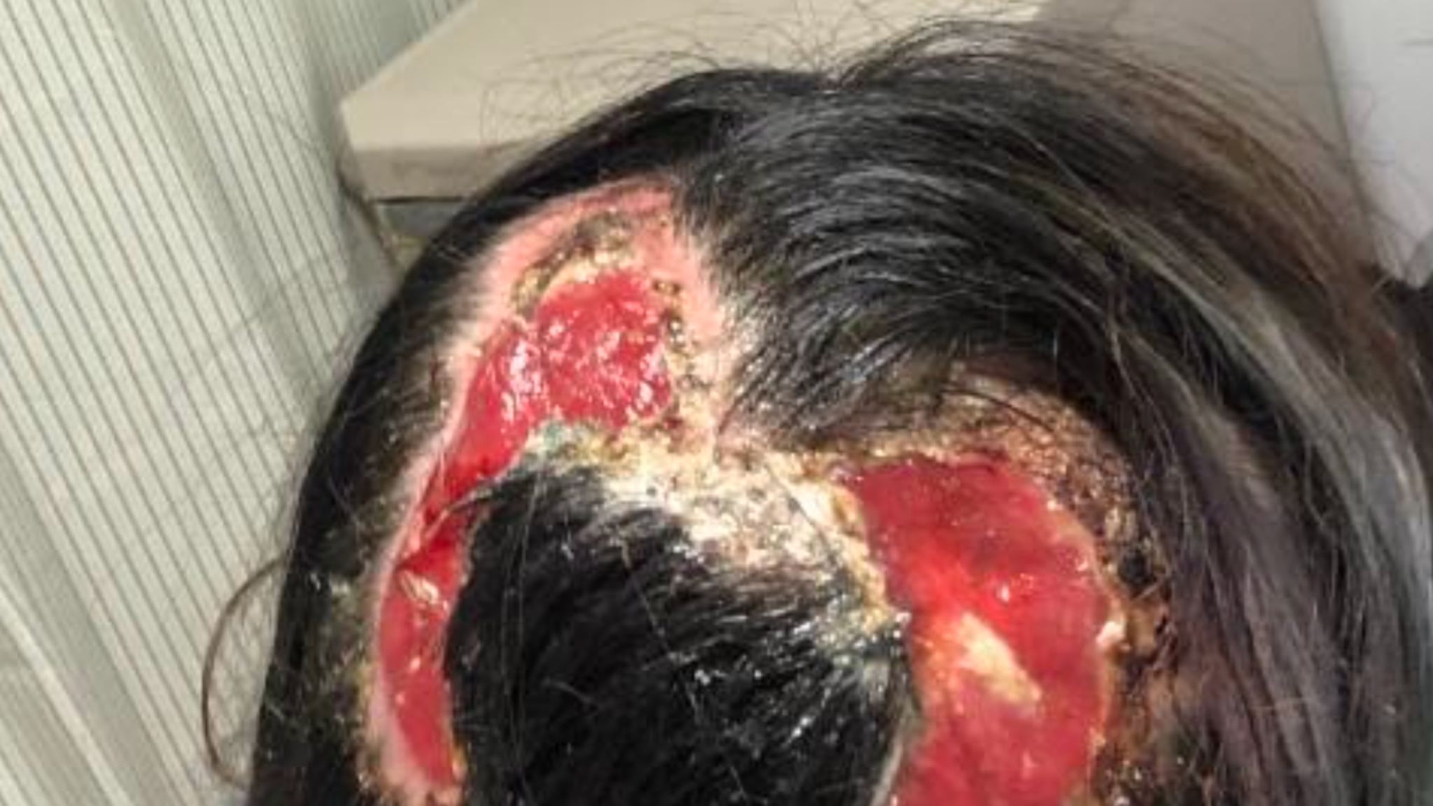 Model Had Razor Attack Model Sues Conair For Alleged Scalp Damage
