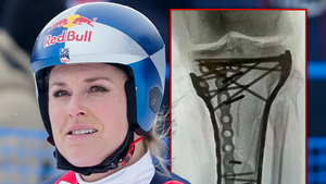 lindsey vonn surgery