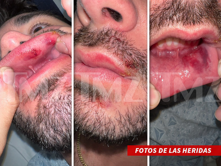ack Doherty new -- Sued for Assault and Battery For Bodygaurd - "Fotos de las heridas