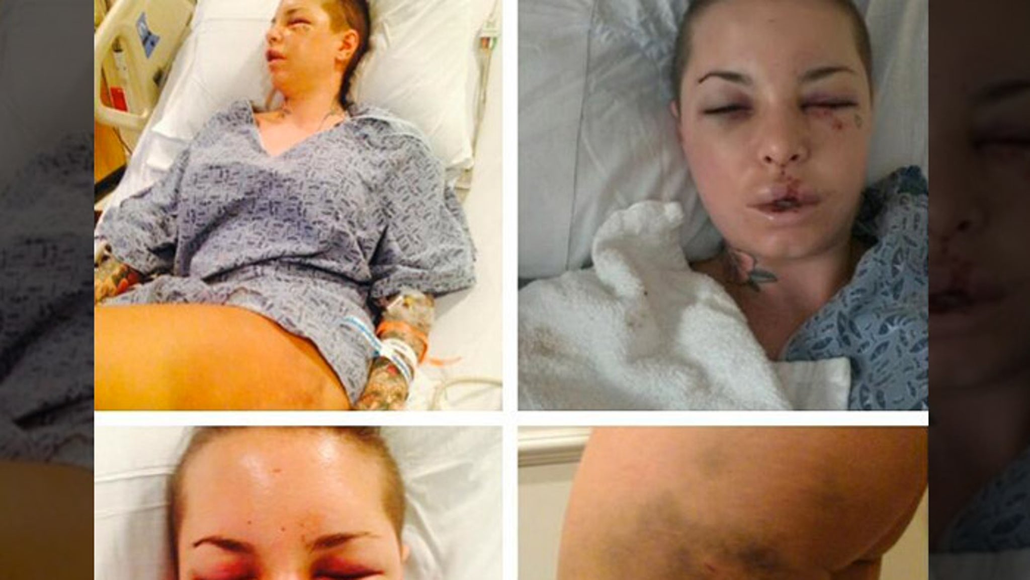 Broken Neck Porn - Christy Mack -- War Machine Almost Killed Me ... 18 Broken Bones, Ruptured  Liver
