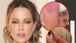 kate beckinsale injury