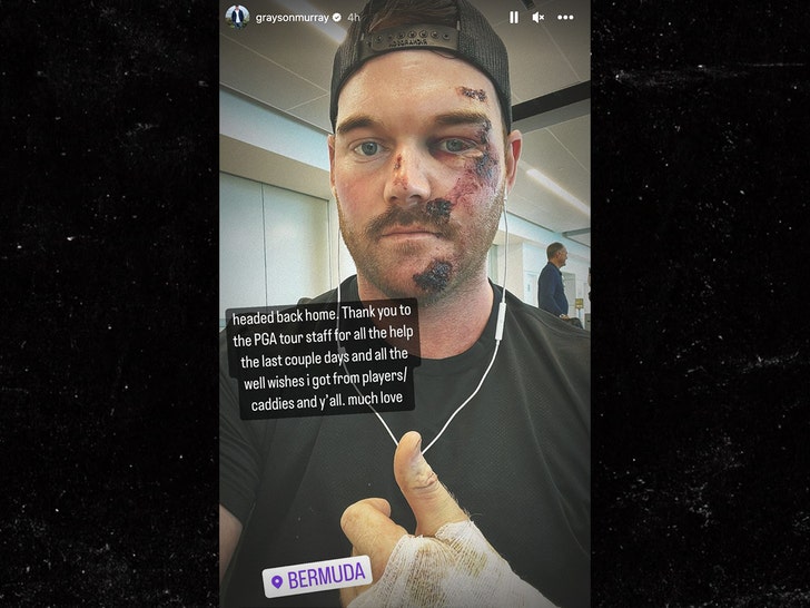 PGA Tour’s Grayson Murray Injured In Horrific Scooter Accident, Wanted 50 Stitches