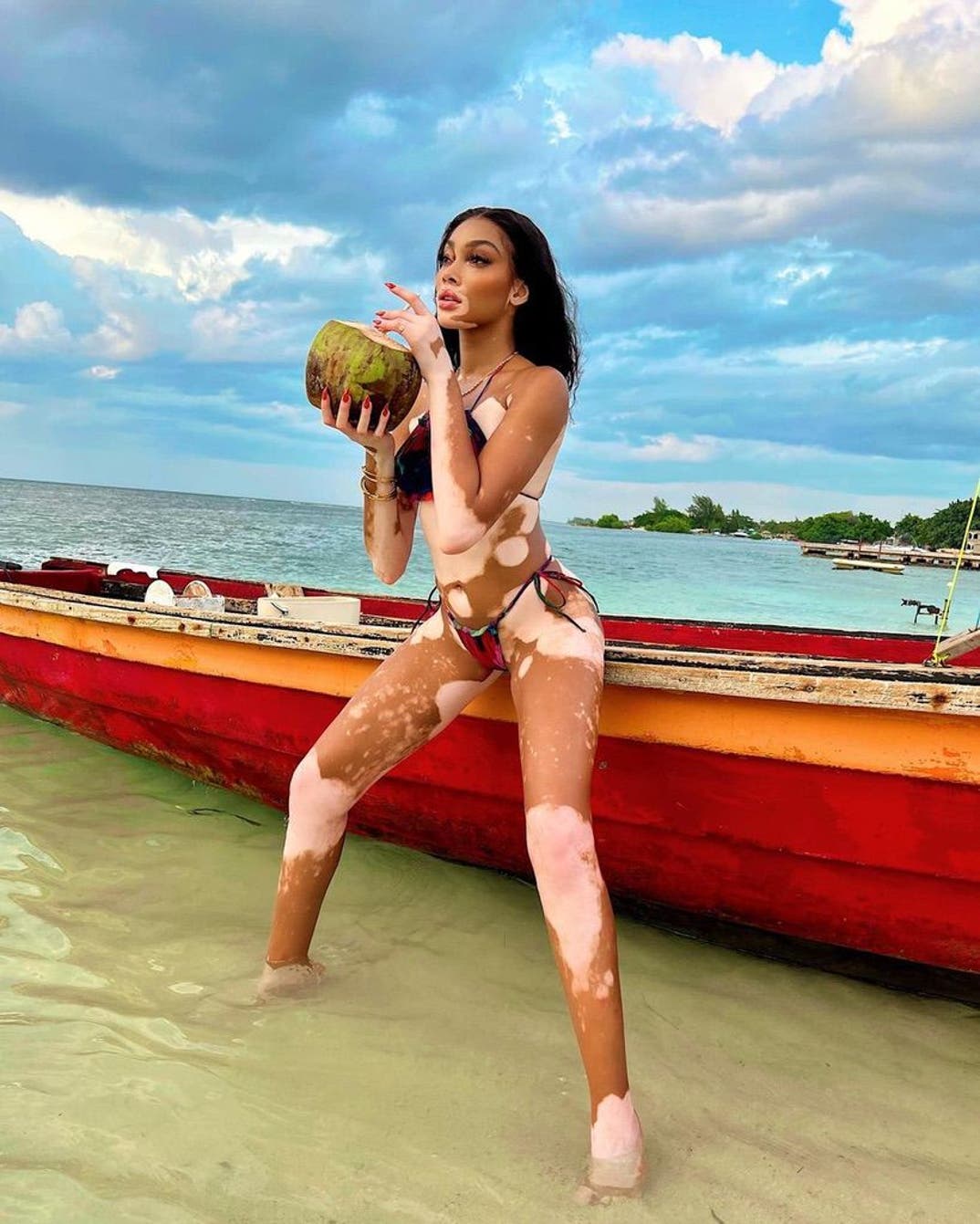 Winnie Harlow