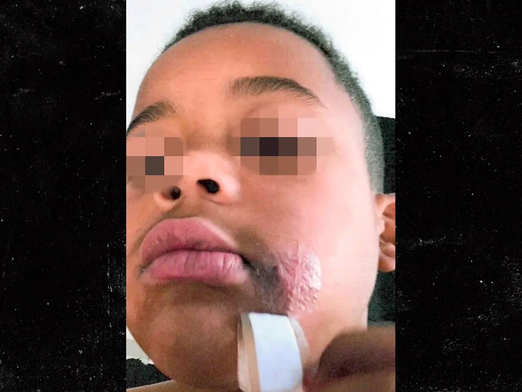 aaron donald kids dog bites