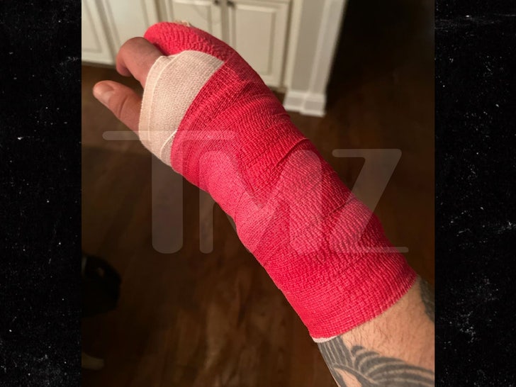 chris kirkpatrick broken hand tmz watermark