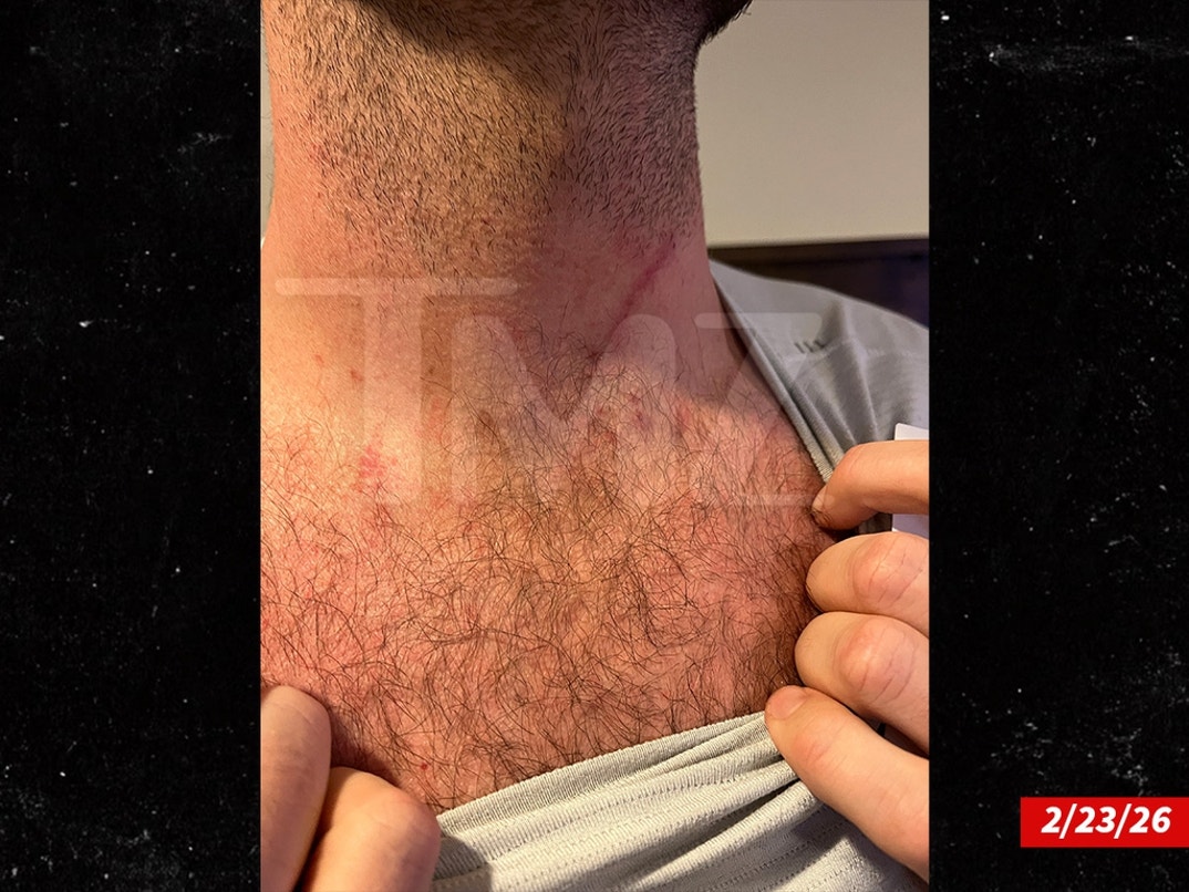 Dakota-Mortensen-Alleged-Injuries-Swipe- 2